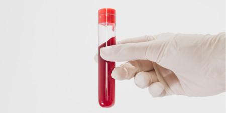 Królewska choroba. Mutacja może się pojawić w każdej rodzinie