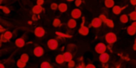 99,9% przypadków wścieklizny wciąż kończy się śmiercią