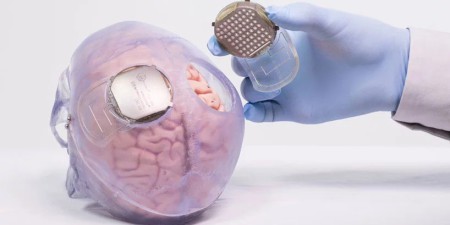 Prof. Horban: większość chorych na COVID-19 nie wymaga specjalistycznego leczenia